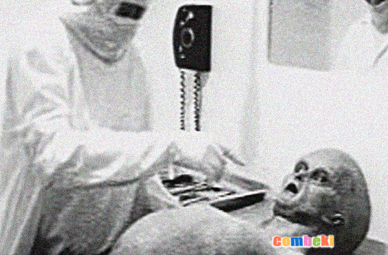 İddia edilen uzaylı cesedi | Alleged alien corpse