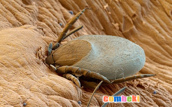 Böceklerin Mikroskopta Görünümü - Hakkında Geniş Bilgi Pembebere.com