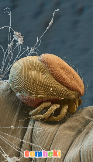 Böceklerin Mikroskopta Görünümü - Hakkında Geniş Bilgi Pembebere.com